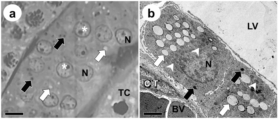 Leydig cell morphology in Desmodus rotundus testes under light (a) and transmission electron microscopy (b).png
